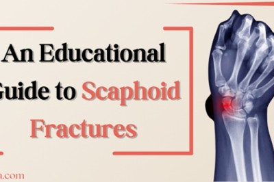 An Educational Guide to Scaphoid Fractures