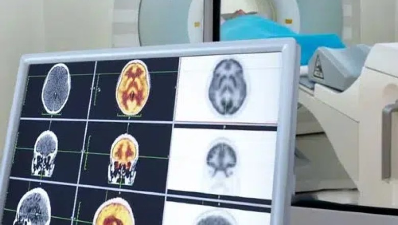 Top 7 Benefits of CT of the Sinuses Without Contrast