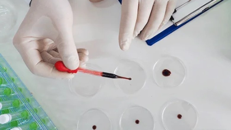 7 Vital Facts on Cardiac Enzymes for Fast emergency care