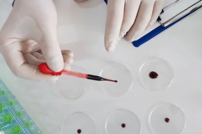 7 Vital Facts on Cardiac Enzymes for Fast emergency care