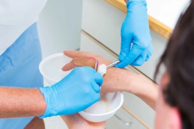 7 Powerful Minor Burn Treatment Tips for Emergency Care