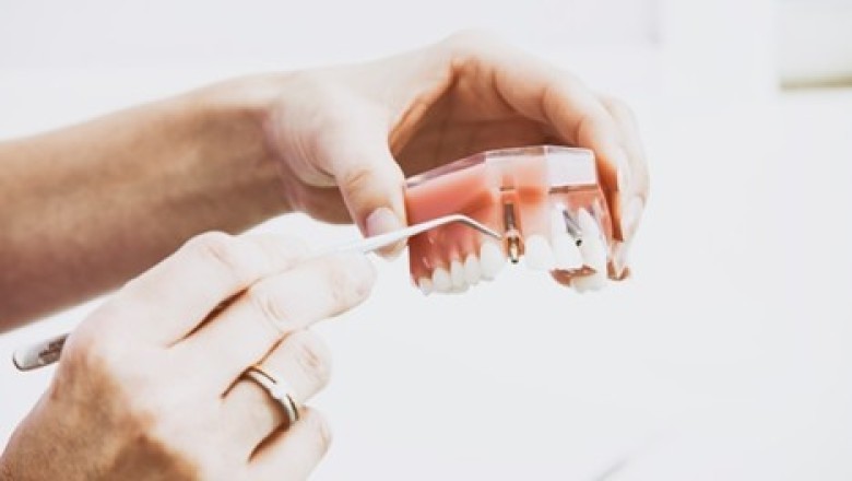 9 Ways Denture Wearers Can Maintain Oral Health
