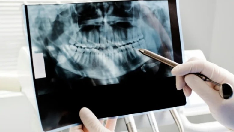 10 Essential Digital X Ray Tips for ER Services Near Me