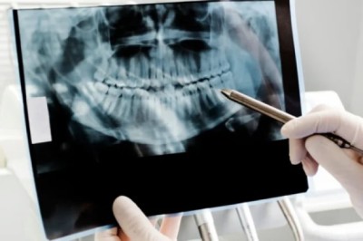10 Essential Digital X Ray Tips for ER Services Near Me